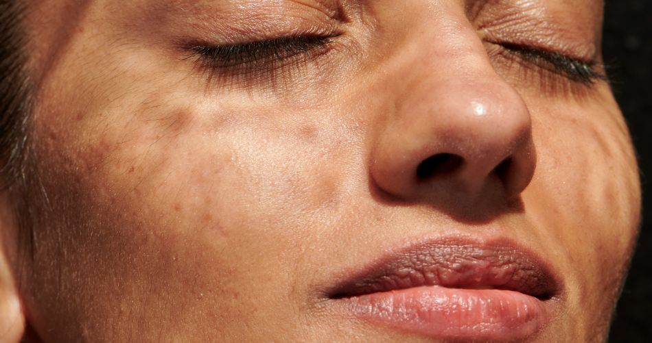 We love the sun... but be careful! Our summer skincare tips